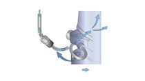 Frischwasserspülsystem